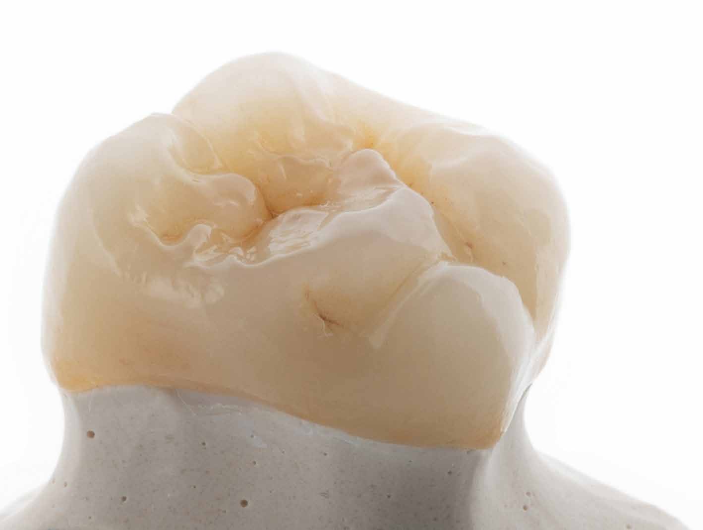 Zirconia service image